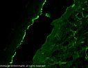 IgG: Nachweis von Immunglobulin G-Ablagerungen (leuchtendes Grün) im Dach und am Boden der durch die Autoimmunreaktion verursachten Blase