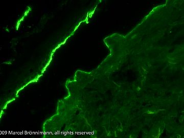 Beispiele direkte Immunfluoreszenz-Untersuchung